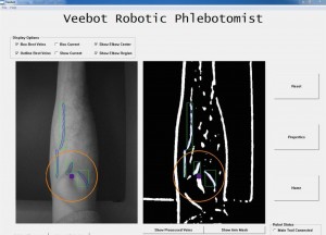 Veebot-Robotic-Phlebotomist